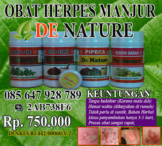 Illustration for article titled lidah buaya sebagai obat herpes